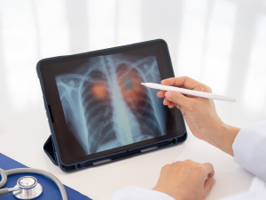 Basic Health Check Package for Smokers