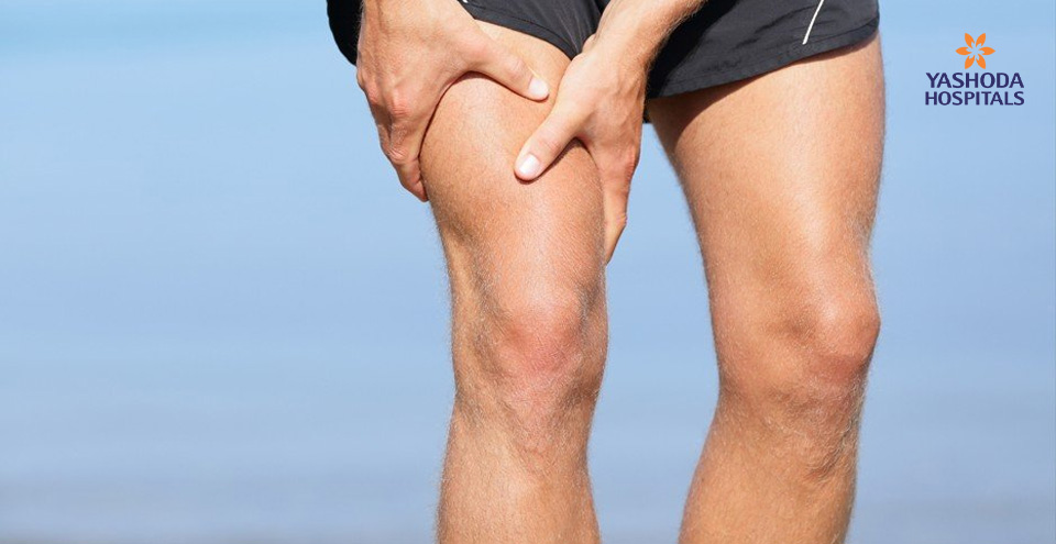 Compartment Syndrome can be acute (severe injury) or chronic (athletic exertion).