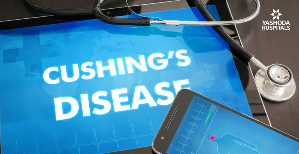 What is Cushing’s Disease?