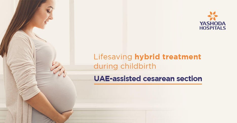 Cesarean sections in cath lab – Uterine artery embolization. Life-saving for the mother!