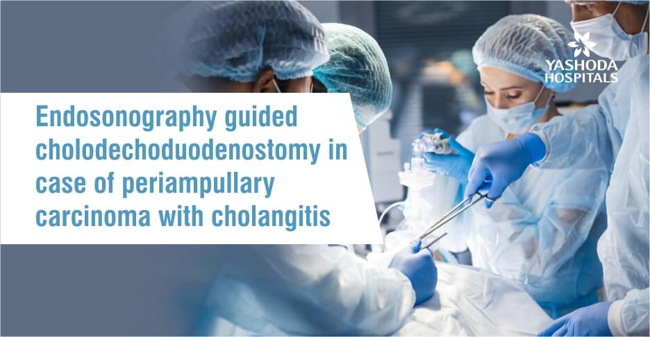 Endosonography guided cholodechoduodenostomy in  case of periampullary carcinoma with cholangitis