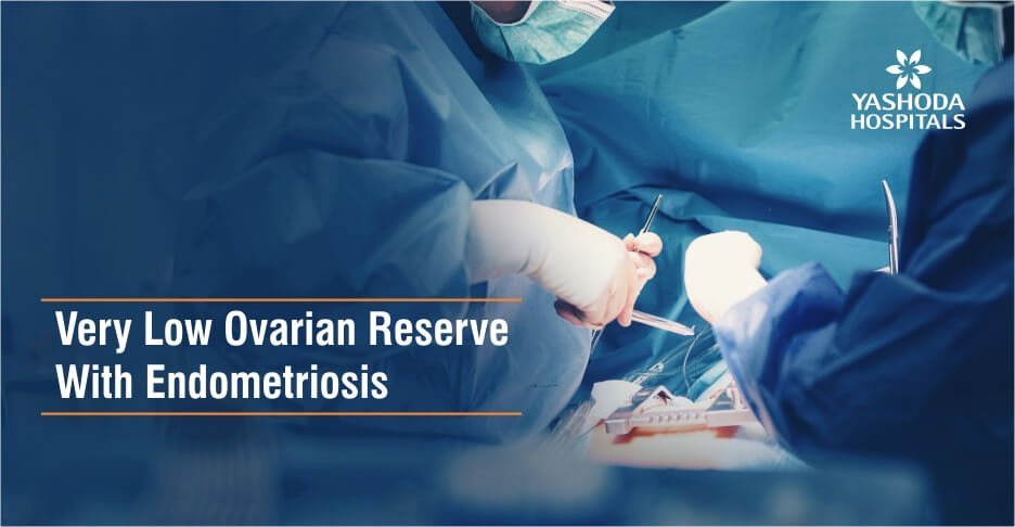 Fertility treatment for Low Ovarian reserve