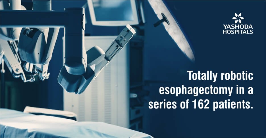Totally robotic esophagectomy in a series of 162 patients