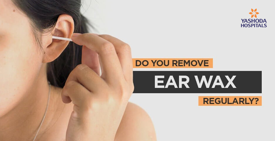 Do you remove earwax regularly?