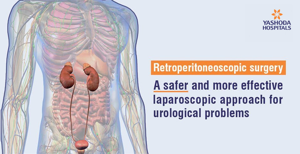 Retroperitoneoscopic surgery for urological diseases