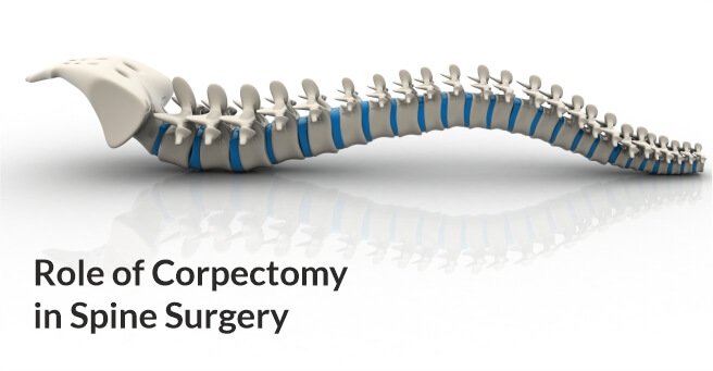 Role of Corpectomy in Spine Surgery