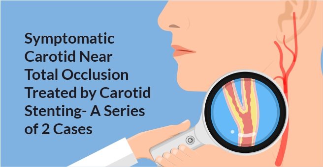 Symptomatic Carotid Near Total Occlusion Treated by Carotid Stenting