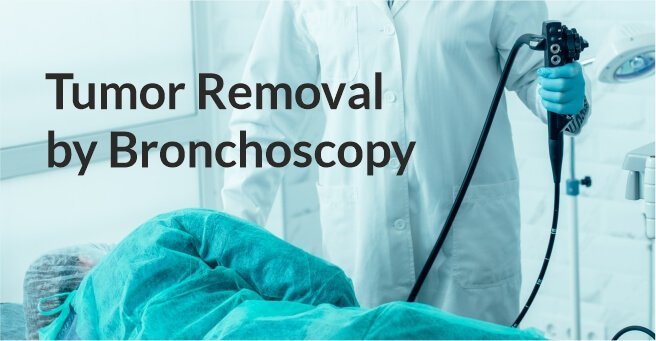 Tumor Removal by Bronchoscopy