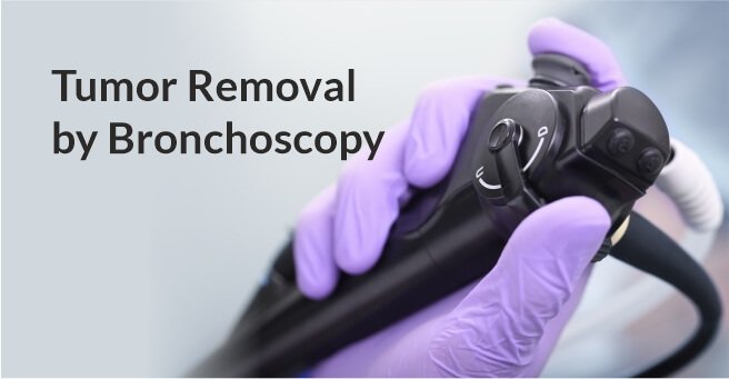 Tumor Removal by Bronchoscopy