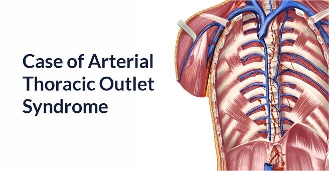 Case of Arterial Thoracic Outlet Syndrome