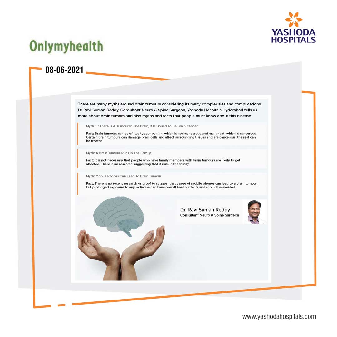 Brain tumor myths and facts