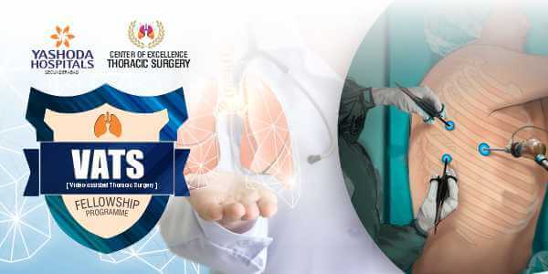 Center of Excellence Thoracic Surgery