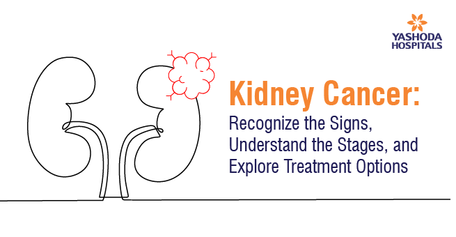 Kidney Cancer