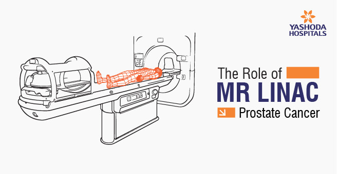 MR Linac in Prostate Cancer