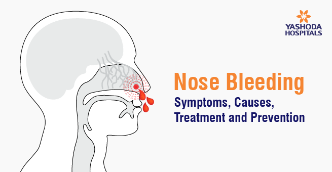 Nosebleeding blog banner