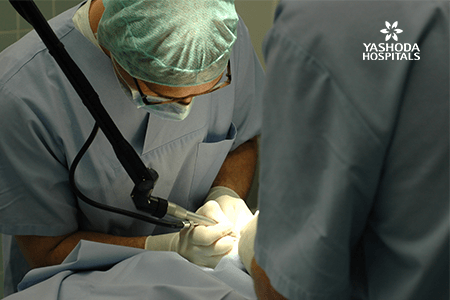 Advanced Laser treatment for piles or hemorrhoids, fistula & fissures, colorectal polyps, & pilonidal sinus  class=