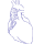 Bentall Procedure