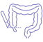 Appendectomy