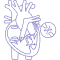 Ventricular Septal Defect (VSD)