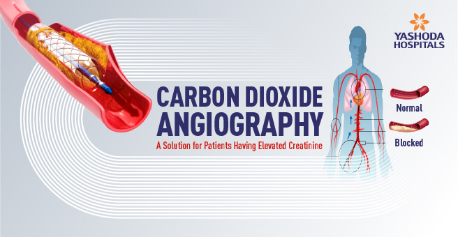 Angiography Main Banner