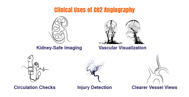 Angiography