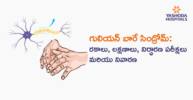 గులియన్ బారే సిండ్రోమ్: రకాలు, లక్షణాలు, నిర్ధారణ పరీక్షలు మరియు నివారణ