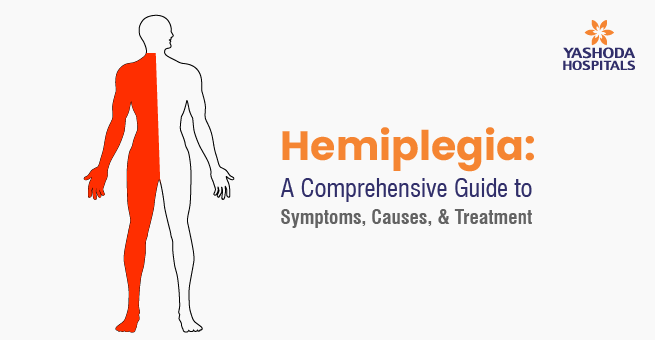 Hemiplegia: A Comprehensive Guide to Symptoms, Causes, & Treatment