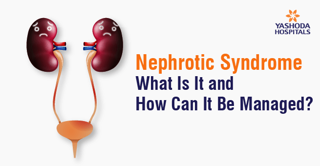 Nephrotic Syndrome: What Is It and How Can It Be Managed?