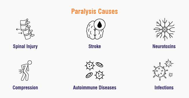 Paralysis attack Causes