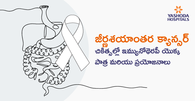 Types of Gastrointestinal Cancer & Role and Benefits of Immunotherapy in Cancer Treatments_Main Banner