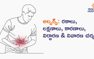 అల్సర్స్: రకాలు, లక్షణాలు, కారణాలు, నిర్ధారణ &  నివారణ చర్యలు