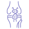 Tension Band Wiring