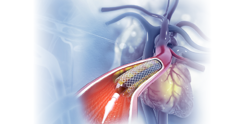 Web Banner_Digital Subtraction Angiography Web Banner_Digital Subtraction Angiography