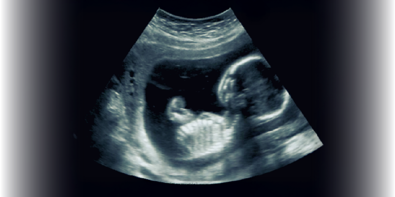 Web Banner_Fetal MRI Web Banner_Fetal MRI