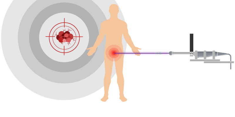 Web Banner_High-Dose Rate-HDR Brachytherapy-06 Web Banner_High-Dose Rate-HDR Brachytherapy-06
