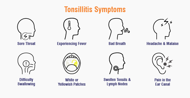 Tonsils Blog_Body 1