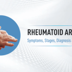 Rheumatoid arthritis main Banner