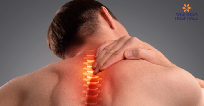 Epidural Steroid Injections1