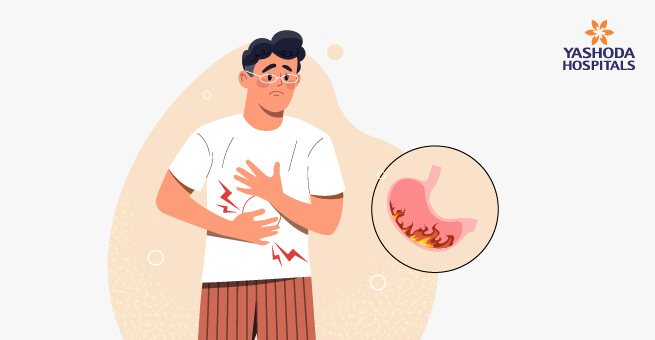Gastric Problem2