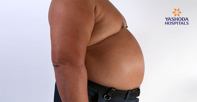 Metabolic syndrome