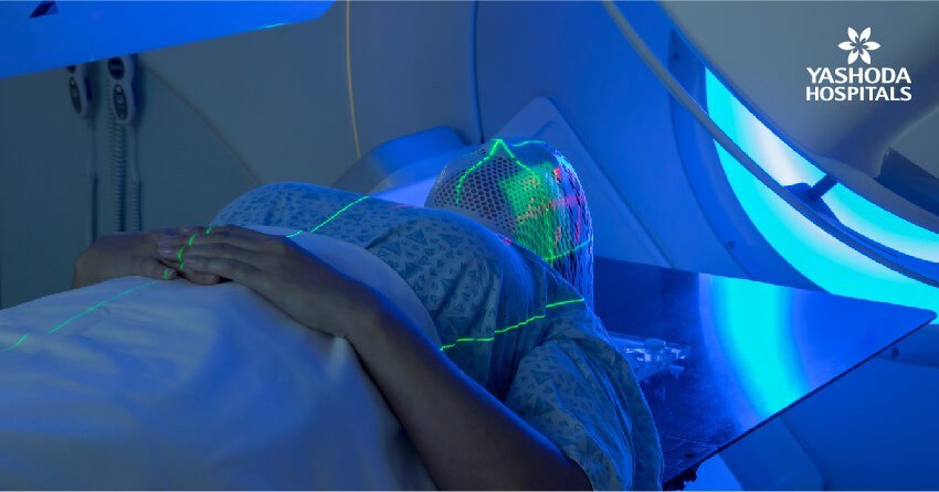 Radiation therapy