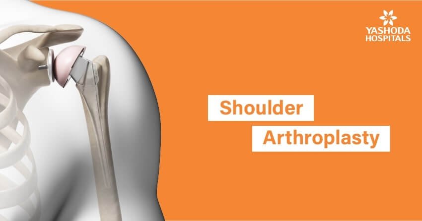 Shoulder replacement surgery procedure