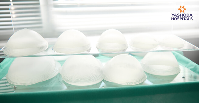 Silicone Implants