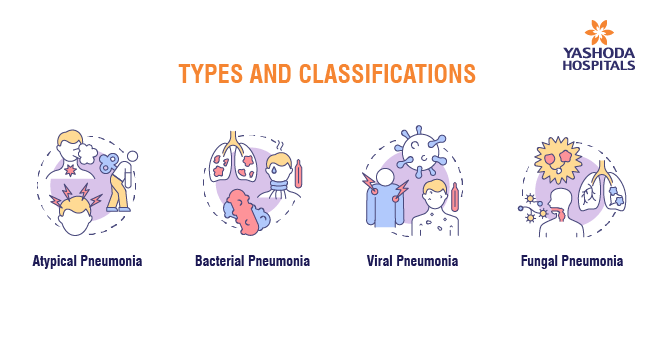 The Pneumonia Handbook_Body 3