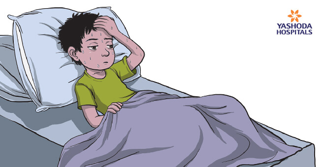 Typhoid fever