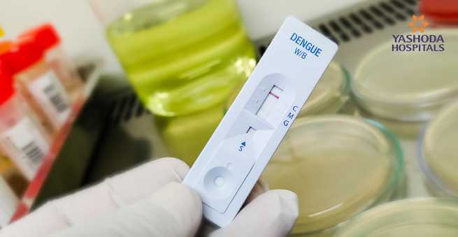 Viral fever diagnosed