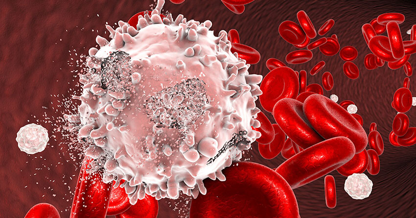 tumors of the kidney are malignant