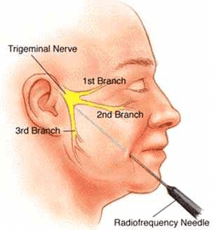 patients who are not fit for surgery