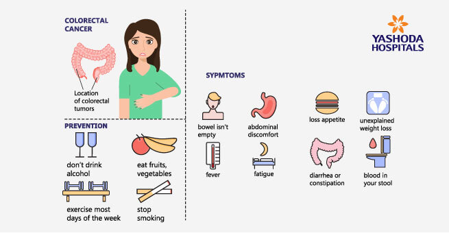 symptoms of colon cancer
