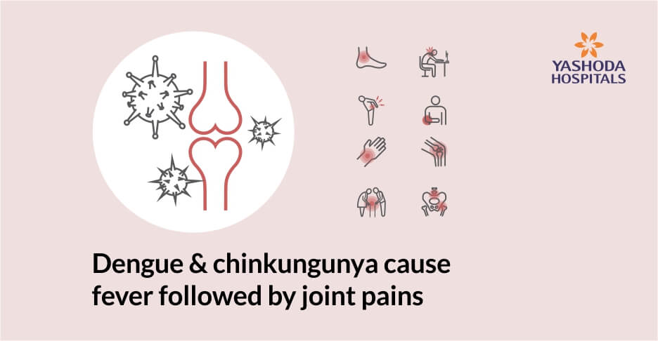 What are the viruses that can cause an arthritis?